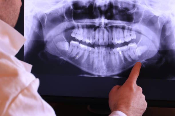 Best Emergency Dentist for Knocked-Out Tooth in Pineville, KY